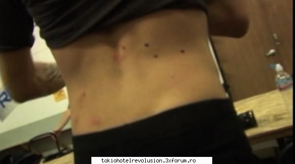 bill   ce-i asta??? :|stiu spatele lui bill,,,dar chestiile alea rosii?