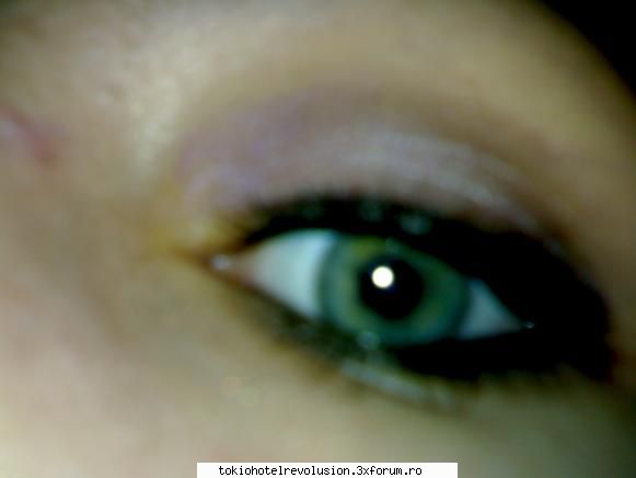 just eye